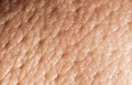 Human skin macro