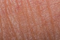 Human skin taken with macro lens, Texture isolated close-up, skin photo for biology Royalty Free Stock Photo