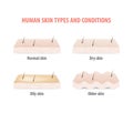 Human skin types and conditions illustration vector on white background. Skin concept. Royalty Free Stock Photo