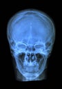 Human skull xray Royalty Free Stock Photo