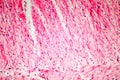 Human smooth muscle