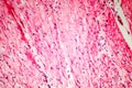 Human smooth muscle