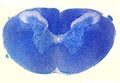 Human spinal cord. Luxol fast blue stain Royalty Free Stock Photo