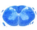 Human spinal cord. Luxol fast blue stain Royalty Free Stock Photo