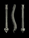 Human Spine Royalty Free Stock Photo