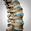 Human Spine Anatomy Section Royalty Free Stock Photo