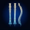 Human spine with intervertebral disks, medically 3D illustration