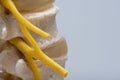 Nerve root exiting spine foramen in spine model Royalty Free Stock Photo