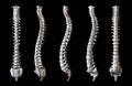 Human Spine pack