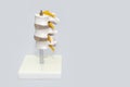 Human spine plastic model for surgery in clinic. Anatomical models of joints and nerves. Part of artificial lumbar spine model in Royalty Free Stock Photo