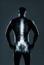 Human spine in x-ray on gray background Royalty Free Stock Photo