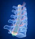 Human Spine x-ray view Royalty Free Stock Photo