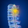 Human Spine x-ray view, Royalty Free Stock Photo