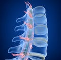 Human Spine x-ray view, Royalty Free Stock Photo