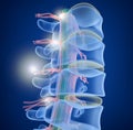 Human Spine x-ray view Royalty Free Stock Photo