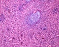 Human spleen. Lymphoid follicle