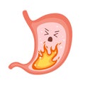 Human stomach on fire. Heartburn, gastritis and acid reflux, indigestion and stomach pain problems. Vector flat cartoon