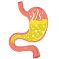 Human stomach. Gastritis and acid reflux, indigestion, vomiting, heartburn and stomach pain problems. Unhealthy stomach concept. Royalty Free Stock Photo