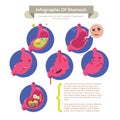 Human stomach infographic -