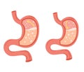 Human stomach set. Gastroesophageal reflux disease concept. Unhealthy stomach concept. Heartburn, illness, discomfort, pain. Flat Royalty Free Stock Photo