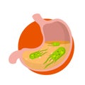 Human stomach. Virus and bacteria inside the body. Green micro-organism