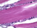 Human striated muscle under microscope