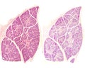 Human submandibular gland