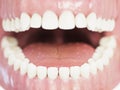 The human teeth Royalty Free Stock Photo