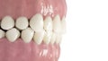 the human teeth Royalty Free Stock Photo