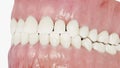 The human teeth Royalty Free Stock Photo