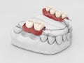 Human teeth with denture. 3d illustration white Royalty Free Stock Photo