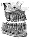 Human teeth whose roots are bared to show the entry of nerves and blood vessels.