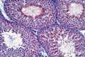 Human testis under the light microscope view. Shows spermatogonia, spermatocytes in meiosis, spermatids, and spermatozoa Royalty Free Stock Photo
