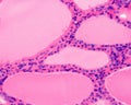 Human thyroid gland. Thyroid follicle epithelium