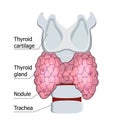 Human thyroid gland isolated on the white background. Hypothyroidism concept vector. Endocrinology diagnose illustration. Thyroid