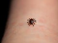 human tick with blood skin