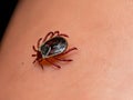 human tick with blood skin