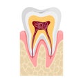 Human tooth anatomy in cross section. Nerves and blood vessels. Flat vector illustration isolated on white Royalty Free Stock Photo