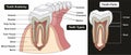 Human tooth anatomy infographic diagram Royalty Free Stock Photo