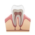 Human tooth structure Royalty Free Stock Photo