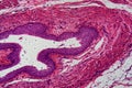 Human transitional epithelium under the microscope Royalty Free Stock Photo