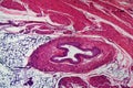 Human transitional epithelium under the microscope Royalty Free Stock Photo