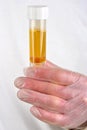 human urine in a sample bottle Royalty Free Stock Photo