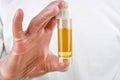 human urine in a sample bottle Royalty Free Stock Photo