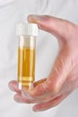 human urine in a sample bottle Royalty Free Stock Photo