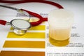 Human Urine Sample. Royalty Free Stock Photo