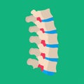 Human vertebrae lumbar backache illness patient vector icon. Skeletal sick spine back bone column disc medical Royalty Free Stock Photo