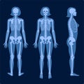 Skeleton x ray Royalty Free Stock Photo