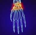 Human wrist anatomy. Xray view. Medically accurate illustration