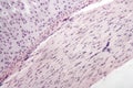 Hyaline cartilage